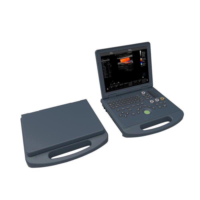 Color Doppler