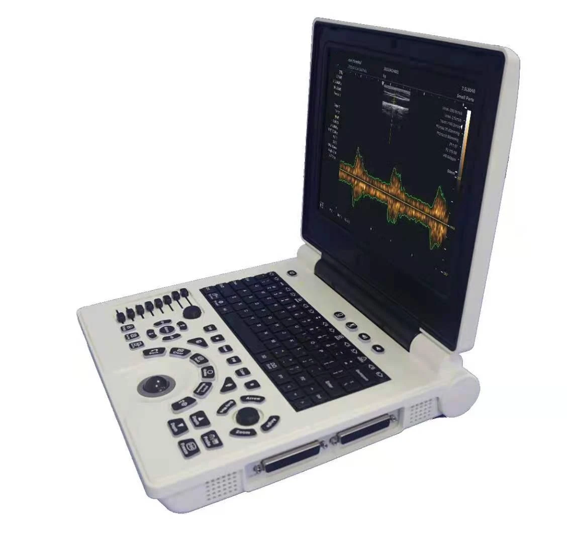 color doppler ultrasound scanner