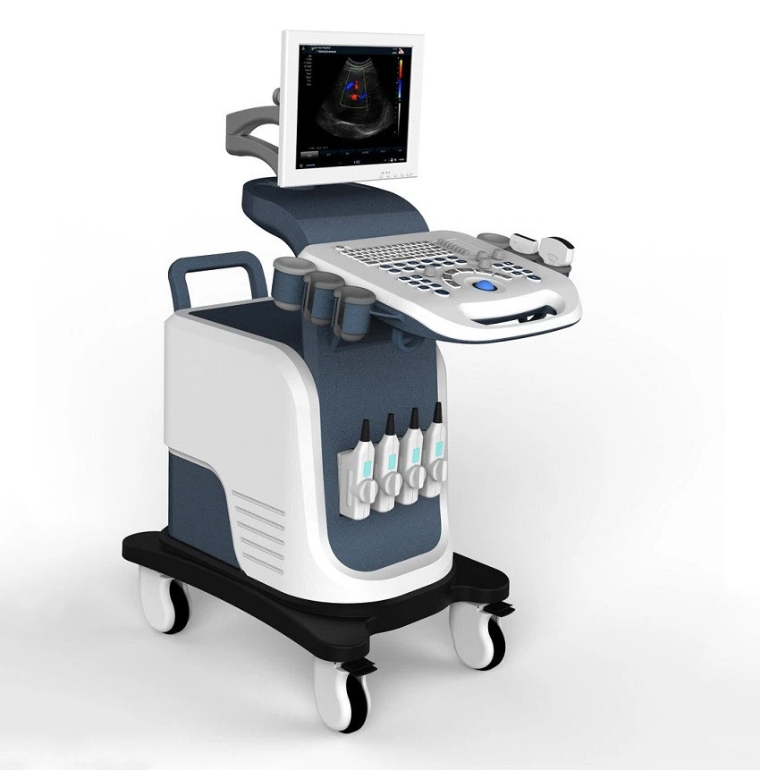 trolley color Doppler Ultrasound