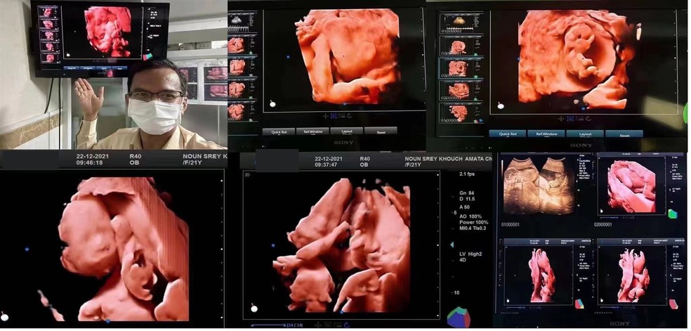 usg scan usg scan