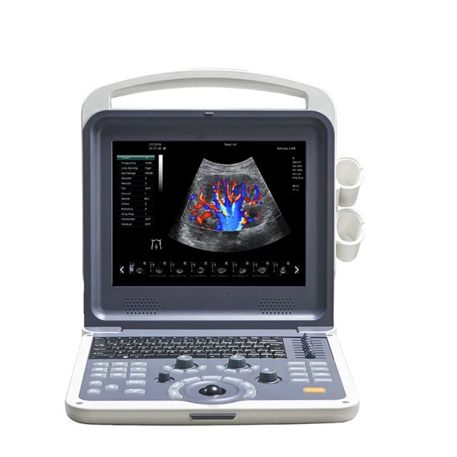 3D/4D Portable Color Doppler skener