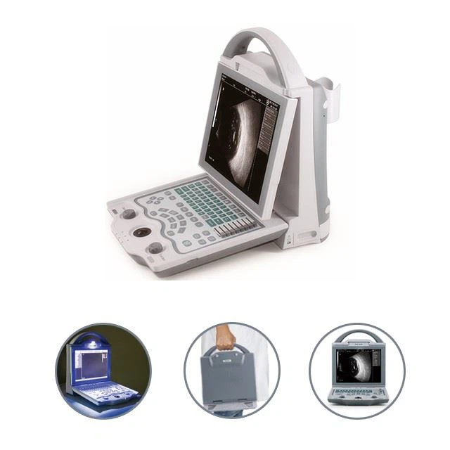 Ophthalmic Ultrasonic A/B Scan