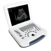 OB-GYN Full-Digital Laptop Ultrazvučni sistem
