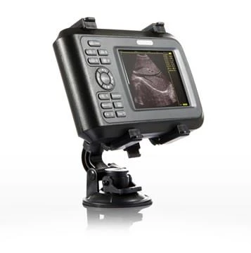 YJ-V20 Medical Ultrasound Scanner With Rectal Probe