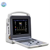 4D kolor dopler potpuno digitalni kolor dopler ultrazvučni dijagnostički sistem